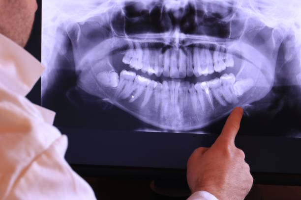 Best Emergency Root Canal Therapy in Algona, IA
